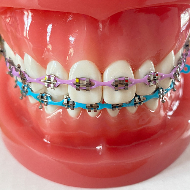 Orthodontic Bracket Queen Series Dental Braces MBT/ROTH Metal 0.018/0.022 Manual CE Certified RS