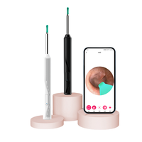 Otoscope sans fil HD pour le retrait du cérumen avec caméra, outil de retrait du cérumen électrique rechargeable par USB, nettoyeur d'oreille intelligent WIFI