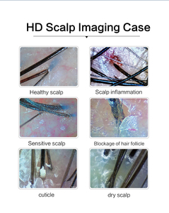 เครื่องวิเคราะห์เส้นผมแบบพกพาเครื่องวิเคราะห์เส้นผม10นิ้วเครื่อง50X หน้าจอ HD/หัววัด200X สำหรับร้านเสริมสวยและใช้ในบ้าน - Product Image 4