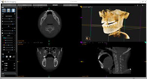 Conveniente Usato Carestream: Combinazione Panoramica CS 9000C 3D Panorex CEPH CONE BEAM per Imaging Panoramico e Cefalometrico - Product Image 2