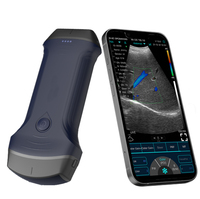Sonda de Ultrasonido Doppler Color Portátil Inalámbrica de Doble Cabezal Convexo+Lineal