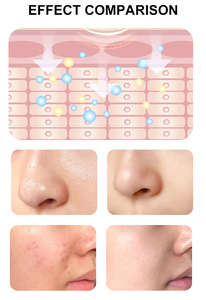 เครื่องตรวจจับสภาพผิวอัจฉริยะ 2026 8 in 1 บำรุงผิวหน้าอย่างล้ำลึก ทำความสะอาดผิวหน้า ลดเลือนริ้วรอย ต่อต้านริ้วรอยแห่งวัย เครื่องสปา - Product Image 5