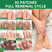 YECUCE 32 pièces Patchs réparateurs d'ongles hypoallergéniques à action rapide Traitement antifongique des ongles de pied en 8 heures de nuit