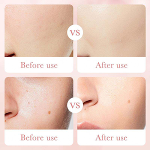 Suero Facial de Rosas de Marca Blanca con Ácido Hialurónico, Hidratante Orgánico y Blanqueador - Product Image 6