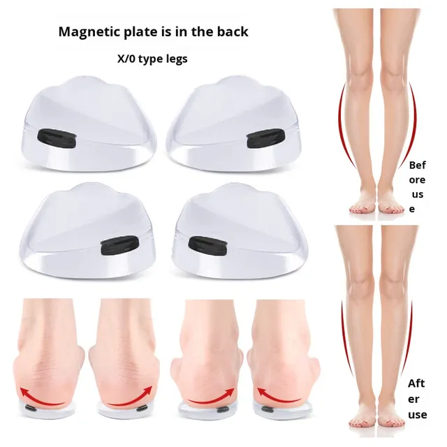 Unisex O-Leg X-Leg Positive O Back Magnetic Orthotic Heel Support Pads for Inward and Outward Varus Valgus Anti-Wear