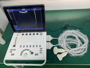 Appareil à ultrasons portable LCD de 15 pouces Dispositif à ultrasons transrectal micro-convexe Dispositif à ultrasons Diagnostic à distance - Product Image 3