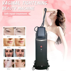 Dispositivo Mais Vendido para Tratamento de Acne, Remoção de Rugas, Lifting Facial, Remoção de Estrias, Remoção de Pigmentação e Reafirmação da Pele - Product Image 5