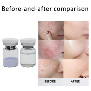 Ensemble de soins de la peau anti-âge, éclaircissant et réparateur au peptide de cuivre bleu liquide avec diluant 5 ml pour le visage - Product Image 3