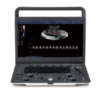 Ecógrafo Doppler Color Portátil SonoScape E2 E2V con un Transductor para Clínica Veterinaria y Hospital