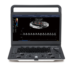 Appareil d'échographie portable Doppler couleur SonoScape E2V avec un transducteur pour clinique vétérinaire et hôpital - Product Image 1