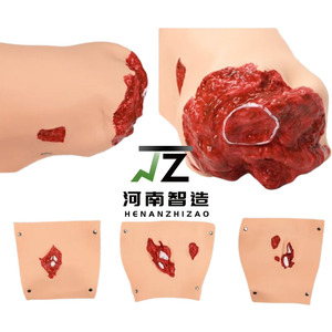 Scienza medica infermiera avanzata per la cura del Trauma <span class=keywords><strong>formazione</strong></span> manichino con moduli di ustioni da Trauma - Product Image 5
