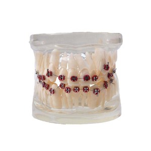 Modèle de dents dentaires/modèle orthodontique <span class=keywords><strong>dentaire</strong></span> avec supports métalliques - Product Image 5
