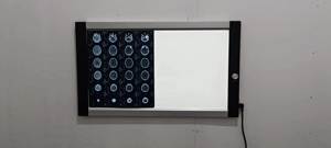 Ein/Doppel/Drei/Vier-Bildschirme zahnärztliches superschlankes Negatoskop LED-Röntgenfolie-Ansichtlicht - Product Image 6