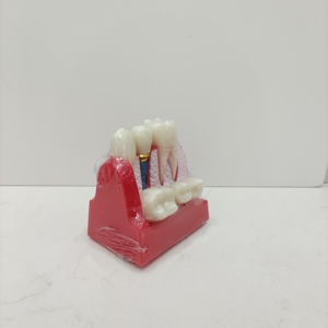 معدات تدريس تشريحية للعلوم الطبية تمرين محاكاة الأسنان عن طريق الفم نموذج زرع الأسنان البشري لدراسة الطلاب - Product Image 2
