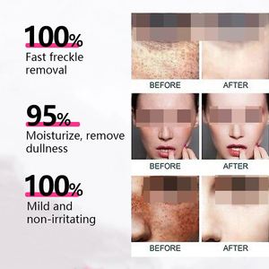 <span class=keywords><strong>Crema</strong></span> Sbiancante Viso e Corpo Anti-Lentiggini con Vitamina C e Collagene, <span class=keywords><strong>Crema</strong></span> Idratante Giorno per Pelle Mista, Fornita da - Product Image 3