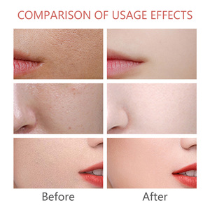 <span class=keywords><strong>Mascarilla</strong></span> Facial en Barra <span class=keywords><strong>de</strong></span> Leche <span class=keywords><strong>de</strong></span> Grano, Suministro <span class=keywords><strong>de</strong></span> Fábrica, <span class=keywords><strong>Mascarilla</strong></span> Rosa Orgánica en Barra, Reparación <span class=keywords><strong>de</strong></span> la Piel y Eliminación del Acné - Product Image 5