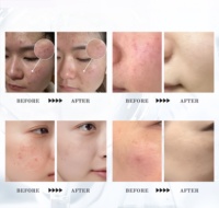 Ampoule Sérum Booster Anti-âge PDRN à 1% de PDRN pur de qualité médicale à base d'ADN de saumon pour la réparation des rides et soins de la peau, Marque Privée