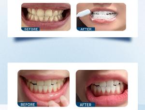 बर्फ कमल गम बचाव सुखदायक दर्द गम मंदी रक्षा टार्टर नियंत्रण तकनीक - Product Image 2