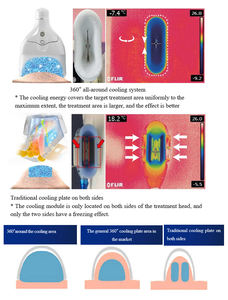 Gran Oferta 2026: Eliminación de Grasa y Celulitis por Congelación para Spa - Product Image 6