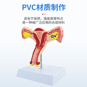 Modelo uterino femenino médico, modelo anatómico de la estructura reproductiva del ovario, modelo de anatomía ginecológica y obstétrica del ovario. - Product Image 2