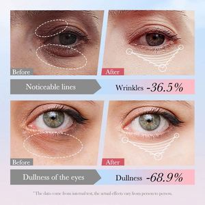 Oem Marque distributeur Crème pour le contour des <span class=keywords><strong>yeux</strong></span> à bille raffermissante et nourrissante à la nicotinamide Sadoer Crème pour l'élimination instantanée des poches des cernes - Product Image 3