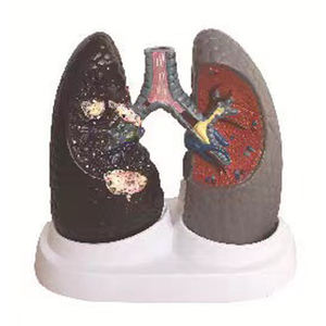 Pabrik langsung sekolah pengajaran manusia model anatomi kronis paru menghalangi Penyakit Paru - Product Image 6