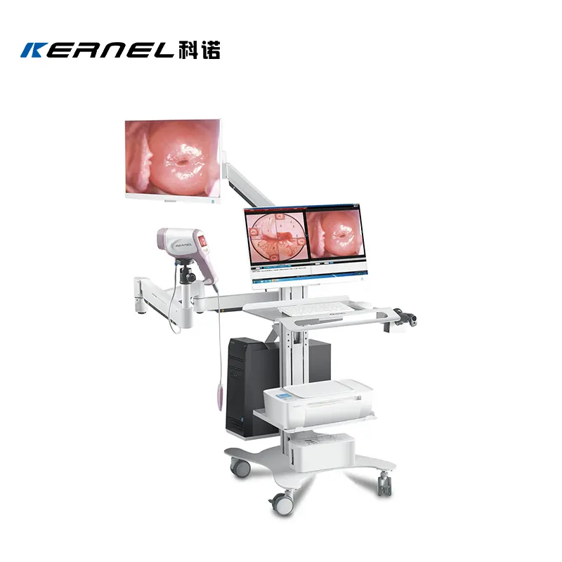 Kernel KN-2200IH HD 3.27MP colposcope KN-2200 colposcopy machine digital video colposcope for gynecology colposcopia allon