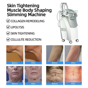 Máquina Profesional VenUs <span class=keywords><strong>Legacy</strong></span> 2.0 Antienvejecimiento, Reafirmante de Piel y Moldeadora Corporal - Product Image 1