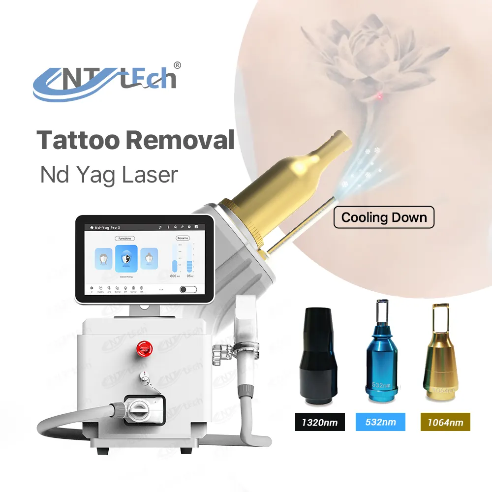 Krachtige Pigmentatie Verwijderen Q Switch 1064nm Draagbare Nd Yag Laser Tattoo Verwijdering Machine