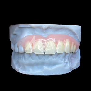 Service d'externalisation de prothèses dentaires flexibles personnalisées, prothèses amovibles Valplast pour laboratoire <span class=keywords><strong>dentaire</strong></span>, acceptation des fichiers STL - Product Image 1