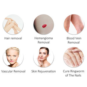 Лазерный аппарат для удаления волос с длинным импульсом 755 нм и 1064 нм Nd:YAG, александритовый лазер - Product Image 6