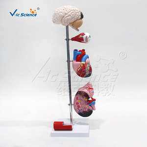 Modèle d'hypertension artérielle : un modèle comparative des vaisseaux sanguins normaux et malades ; un outil pédagogique médical. - Product Image 1