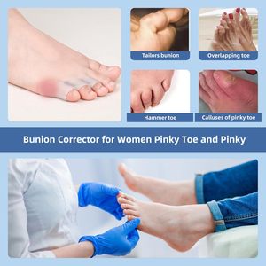 Attelle <span class=keywords><strong>de</strong></span> Correction pour Hallux Valgus en Gel Beige – Séparateur d'Orteils Durable, Respirant et Confortable pour Soulager la Douleur des Orteils Superposés, les Ampoules et les Cors - Product Image 5