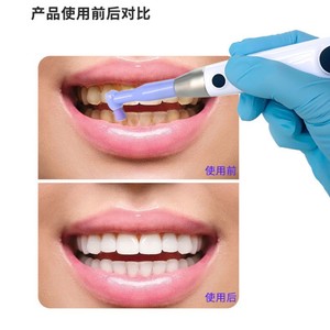 Pulidora Eléctrica de 3000 rpm con Carga Inalámbrica y Pantalla Digital, Herramienta Dental - Product Image 4