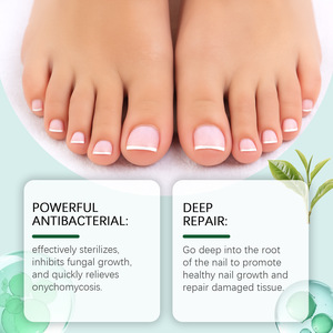 Gel de soin des <span class=keywords><strong>ongles</strong></span> 20g pour la réparation des <span class=keywords><strong>ongles</strong></span> abîmés, la prévention des champignons et la promotion de la croissance des <span class=keywords><strong>ongles</strong></span>, sans logo - Product Image 4