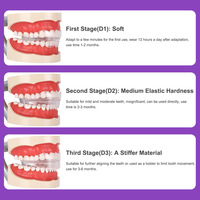 Trois étapes dentition redressement appareil dentaire dents meulage alignement accolades dent orthodontique orthèse bouche garde ensemble