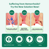 Crème en capsules OEM pour hémorroïdes, soulagement des hémorroïdes internes et externes, des fissures anales, gel crème pour hémorroïdes
