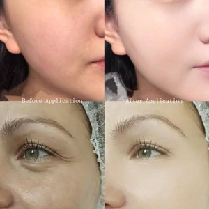 Private Label Kollagen Retinol Hyaluronsäure 7% Tiefenwirksame Feuchtigkeitspflege Wissenschaftlich Bewährte Formel Creme Hautpflege Gesichtscreme - Product Image 6