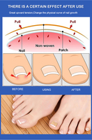 Autocollants de correction des ongles des pieds sans colle et indolores, patchs de soin pour la cicatrisation des ongles