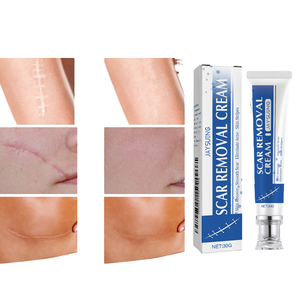 Private Label Strong Effective Scar Removal <b>Cream</b> for Damaged <b>Skin</b> Smooth Tightening Gel to Combat Pimples and Stretch Marks - Product Image 4