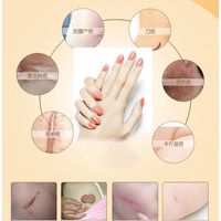 Autocollant médical souple anti-acné, 1 pièce, cache les cicatrices, bande réparatrice, étanche, pratique, bon genre de peau