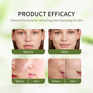 Arbre à thé nettoyant visage à base de plantes blanchissant marque privée traitement de l'acné gel nettoyant visage vegan <span class=keywords><strong>mousse</strong></span> <span class=keywords><strong>nettoyante</strong></span> <span class=keywords><strong>naturelle</strong></span> - Product Image 6