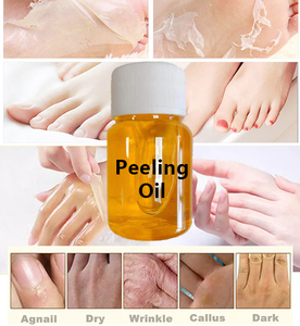 Ingredientes cosméticos para blanquear la solución exfoliante Glicólico <span class=keywords><strong>Aha</strong></span> <span class=keywords><strong>30</strong></span>% Bha 5% Suero <span class=keywords><strong>de</strong></span> ácido hialurónico puro - Product Image 4