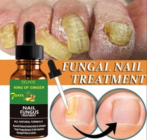 La onicomicosis las uñas de <span class=keywords><strong>los</strong></span> <span class=keywords><strong>pies</strong></span> uñas eliminar <span class=keywords><strong>hongos</strong></span> <span class=keywords><strong>en</strong></span> las uñas antibacteriano Reparación de uñas esencia - Product Image 4