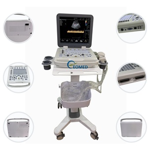 Échographe médical vétérinaire humain ergonomique, système Doppler couleur, clavier rétroéclairé et stockage de données puissant CU30-2 - Product Image 3