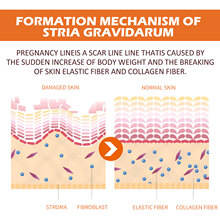 Creme de Massagem OEM 100G com Proteína Neuropeptídeos e Vitamina E para Reduzir a Aparência de Estrias - Product Image 5