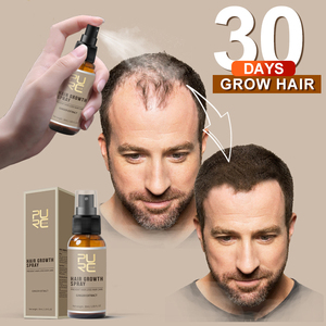 China Manufacturer OEM ODM Ginger Extract <b>Hair</b> <b>Growth</b> <b>Spray</b> With Custom Logo Oragnic Vegan <b>Hair</b> Regrow <b>Spray</b> For Men Women - Product Image 2