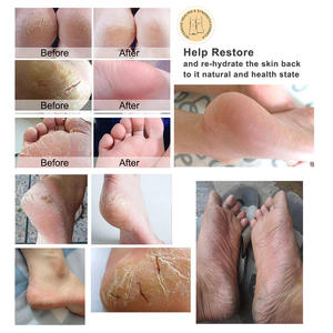 Offre Spéciale Anti Dry Crack Peau Sèche Pied Réparation Adoucissant Pieds Crème Talon Baume - Product Image 6