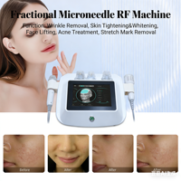 Dispositivo de Cuidado Facial 2 en 1 2026 con Agujas Aislantes para Eliminación de Cicatrices de Acné, Reafirmación, Tensado y Blanqueamiento de la Piel para Salón