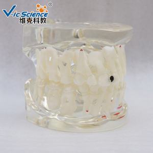 Modelo <span class=keywords><strong>Dental</strong></span> de Patología Educativa en Oferta, Modelo de Dientes Patológicos Semi-Laterales - Product Image 3